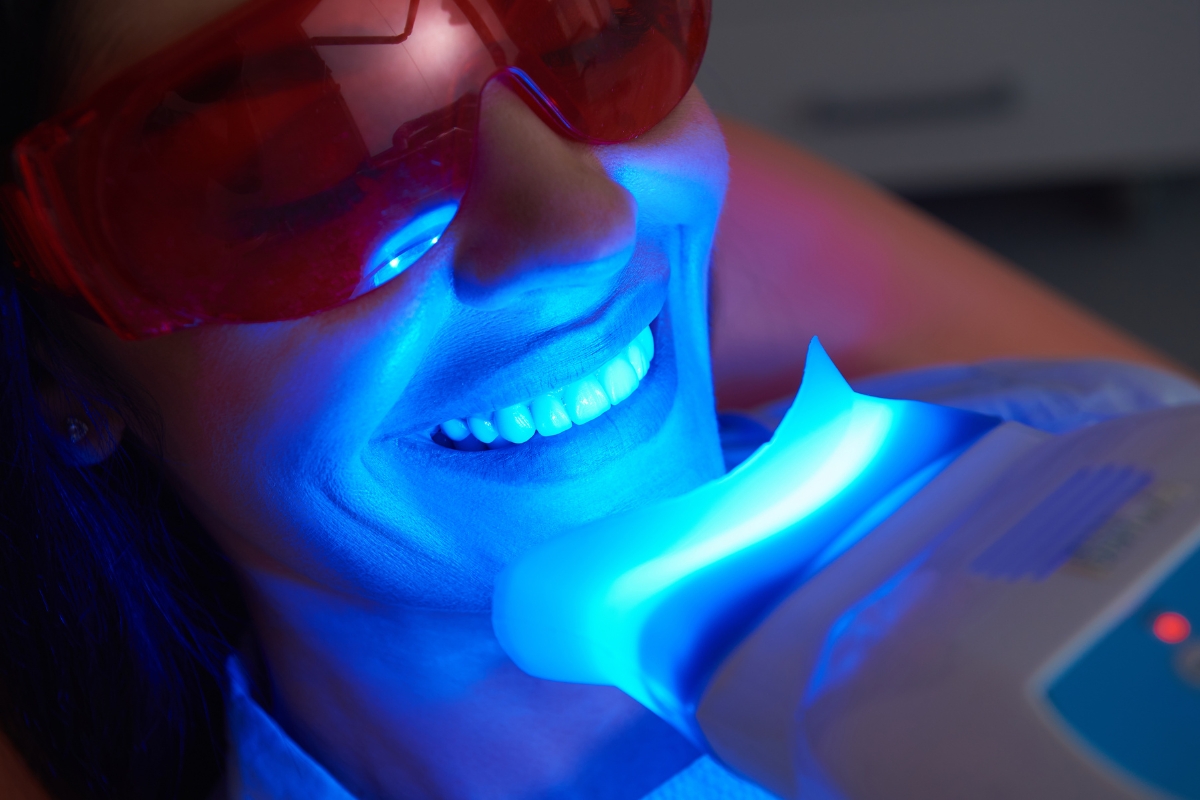 teeth whitening in Lilburn