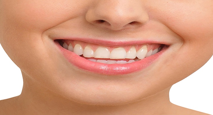 How Long Do Dental Crowns Last